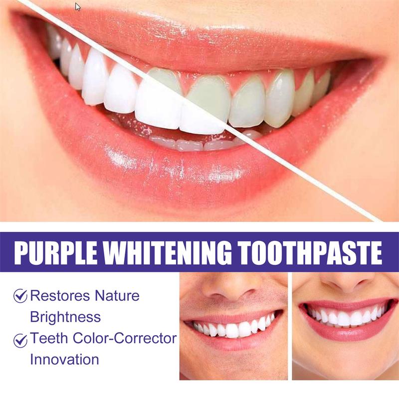 9D Purple Teeth Whitening Toot - огляд і ціна Purple Toning Shampoo