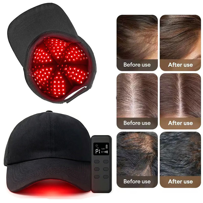 660nm 940nm Light 142 Groups / - огляд і ціна Hair Care Wella