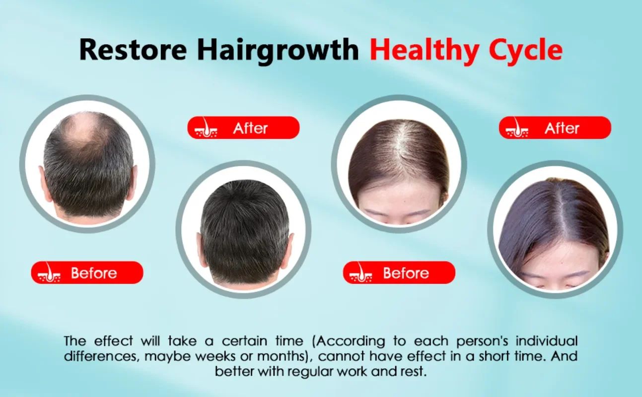Hair Growth Cap Rechargeable 2 - огляд і ціна Hair Care Basic